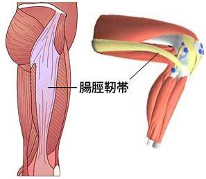 解剖図：腸脛靭帯の位置